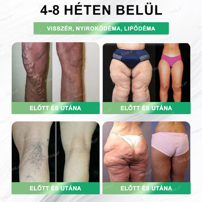 🛡𝑲𝒂𝒂𝑳𝒂® 𝑮𝑳𝑷-1 8 𝒂𝒛 1-𝒃𝒆𝒏 𝑭𝒊𝒕 & 𝑽𝒊𝒕𝒂𝒍 𝑺𝒛á𝒋𝒐𝒏 á𝒕 𝒔𝒛𝒆𝒅𝒉𝒆𝒕ő 𝒐𝒍𝒅𝒂𝒕 – 𝑵𝒂𝒑𝒊 𝒆𝒈𝒚𝒔𝒛𝒆𝒓, 7 𝒏𝒂𝒑 𝒂𝒍𝒂𝒕𝒕 𝒍á𝒕𝒉𝒂𝒕ó 𝒗á𝒍𝒕𝒐𝒛á𝒔 / 𝑬𝒍𝒉í𝒛á𝒔, 𝒔𝒛í𝒗- é𝒔 é𝒓𝒓𝒆𝒏𝒅𝒔𝒛𝒆𝒓𝒊 𝒆𝒈é𝒔𝒛𝒔é𝒈, 𝒄𝒖𝒌𝒐𝒓𝒃𝒆𝒕𝒆𝒈𝒔é𝒈, 𝒂𝒍𝒗á𝒔𝒊 𝒂𝒑𝒏𝒐𝒆, 𝒃é𝒍𝒓𝒆𝒏𝒅𝒔𝒛𝒆𝒓 𝒆𝒈é𝒔𝒛𝒔é𝒈𝒆, í𝒛ü𝒍𝒆𝒕𝒊 𝒑𝒓𝒐𝒃𝒍é𝒎á𝒌 é𝒔 𝒎é𝒈 𝒔𝒐𝒌 𝒎á𝒔 𝒆𝒔𝒆𝒕é𝒏