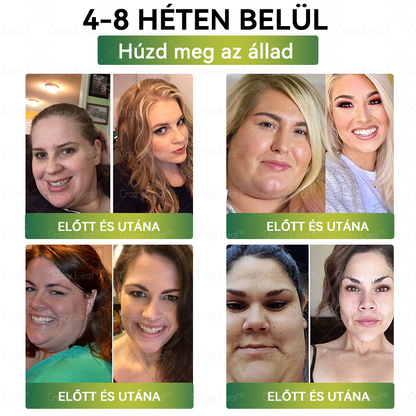 Mayo Klinika által ajánlott | Hivatalos Márkabolt | CrazyLeaf® Meglutide GLP-1 Aktiváló Oralis Oldat – Tartalmaz moringát, NAD+-t és yerba matét, természetes támogatás fogyáshoz, öregedésgátláshoz és cukoranyagcseréhez